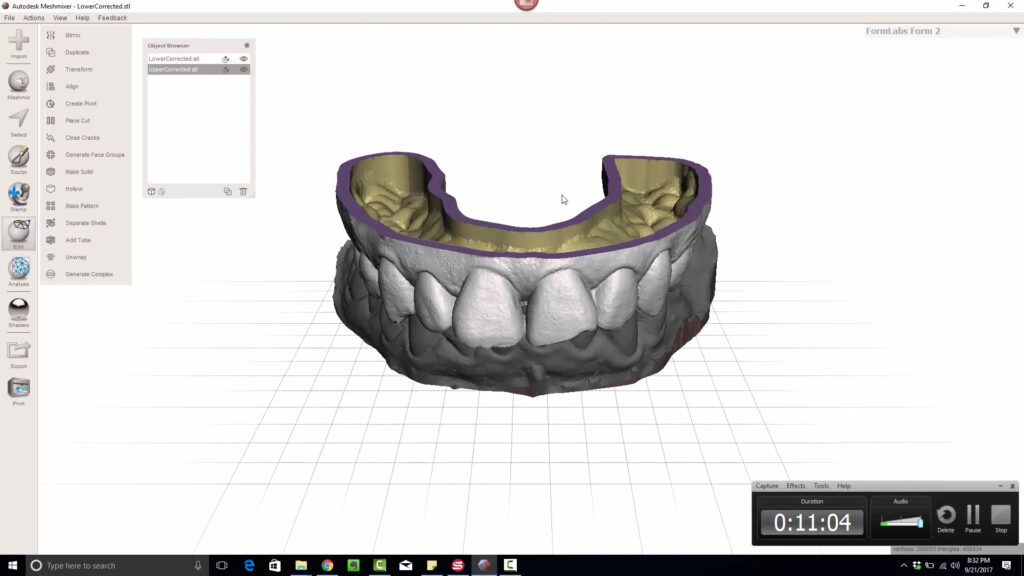 Video 5 of 5_ MeshMixer - Dental Model Making Hollow (2)